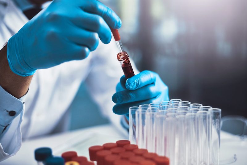 Can Certain Blood Types Cause Increased Risk For COVID-19?