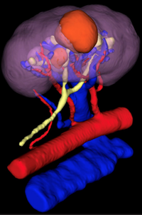 IRIS Image