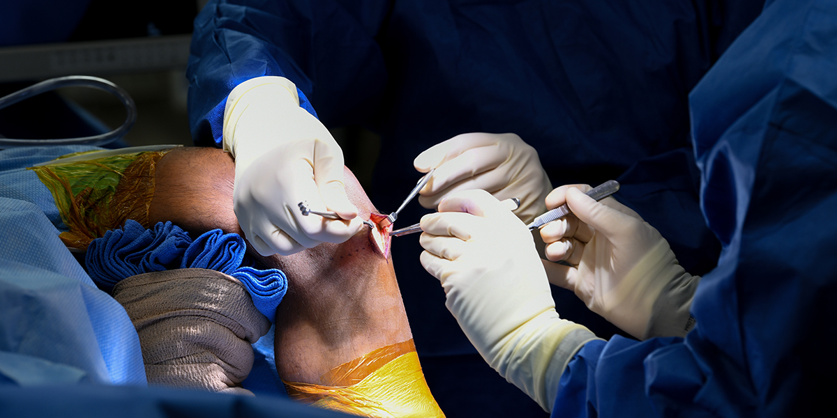 Ortho Knee Revision