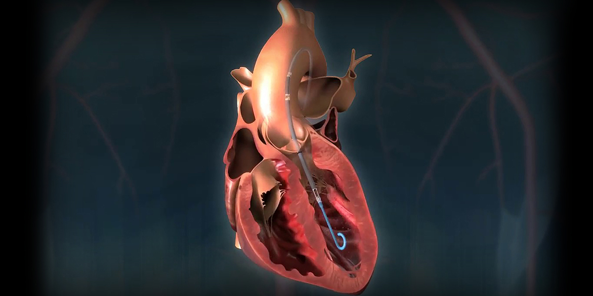 Protect IV