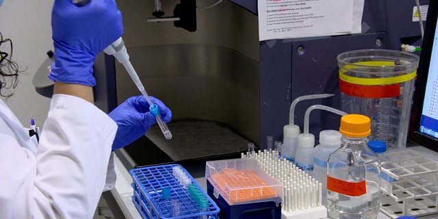 UTI Rapid Test